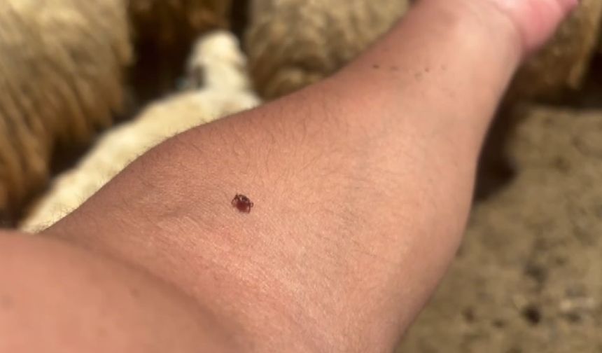 Hastalık riski artıyor: "Gerekirse kendiniz çıkarın